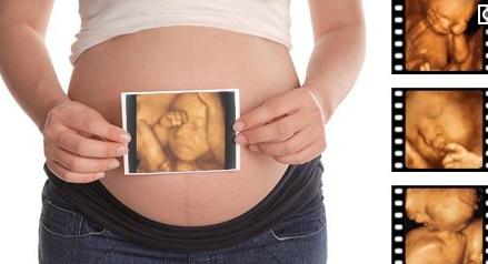 怀孕六个月可以做四维彩超吗?