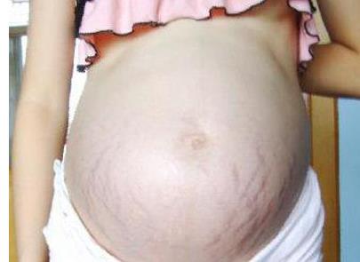 怀孕六个多月怀男孩女孩的肚型介绍!