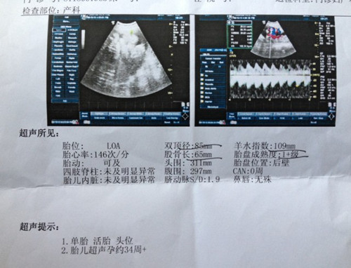 【b超看男女几个月最准】怀孕十四周看胎儿男女准吗