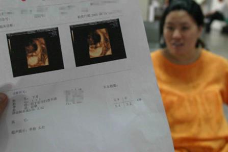 胎儿性别鉴定方法