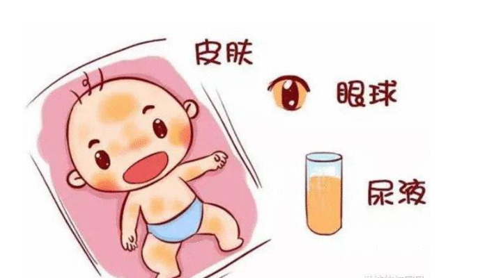 孕妇吃什么宝宝没有黄疸