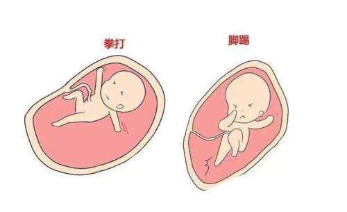 孕晚期胎动减少正常吗.jpg