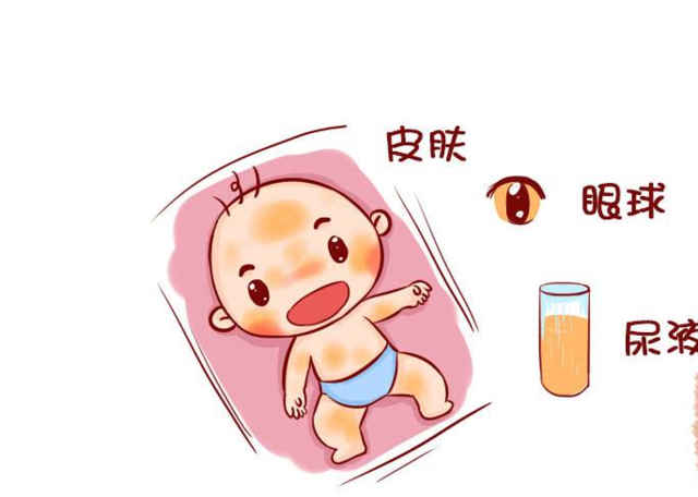 新生儿生理性黄疸的护理方法有哪些.jpg