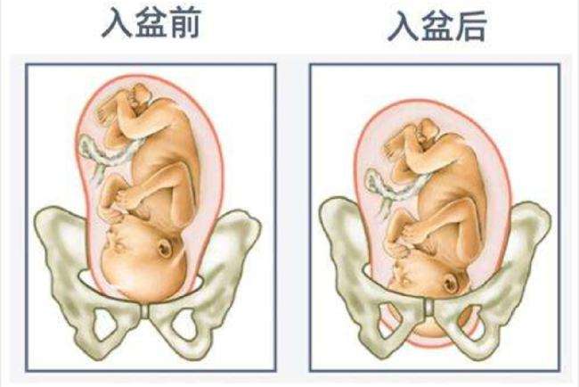 肚子最大的孕妇 入盆图片