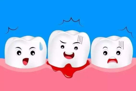 治疗牙龈出血的小妙招有哪些