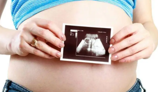 孕妇的妊娠线可以看出男女么.png