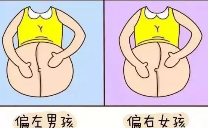 怀男宝女宝妊娠线区别图.png