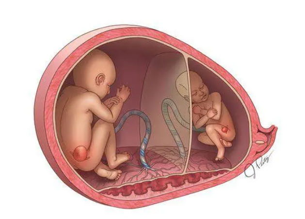 怀孕双胞胎如何判断男女.png