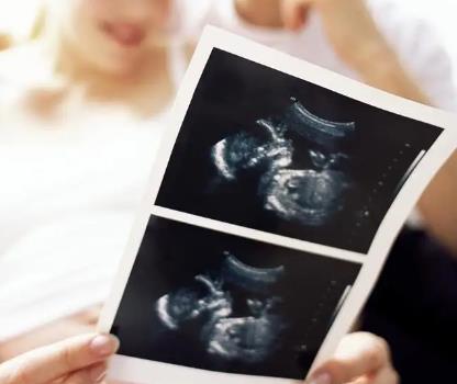 胎儿分辨男女是在几周？B超数据怎么看胎儿性别？.jpg