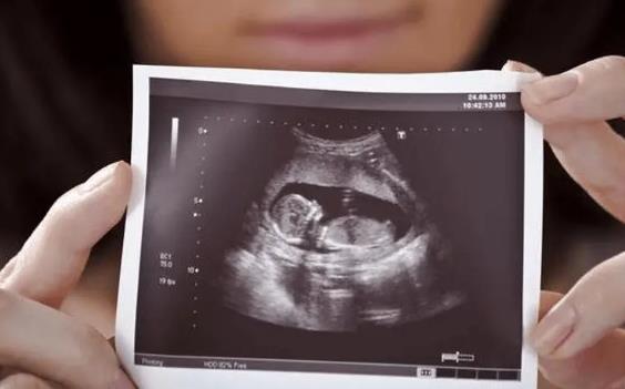 抽血验性别有翻盘的吗？孕期如何看胎儿性别？.jpg