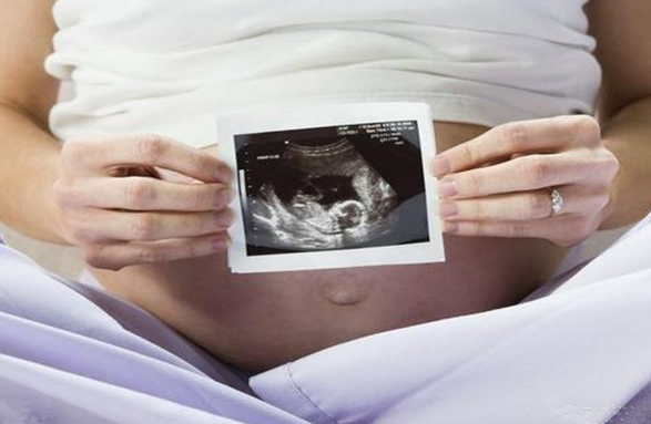 四维彩超怎么看胎儿是男是女呢.png