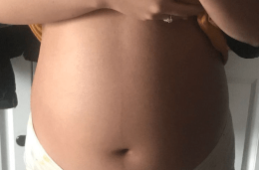 子宫前位更容易生儿子吗,生儿子的症状有哪些.png