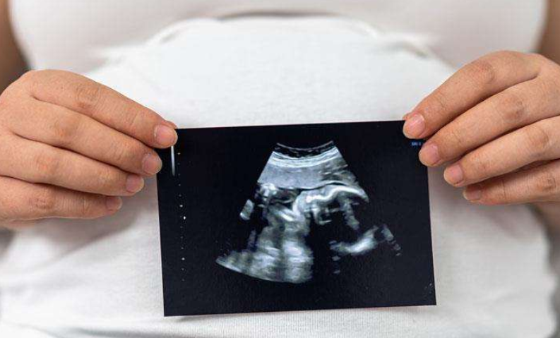 孕期胎位是否可以预测胎儿性别.png