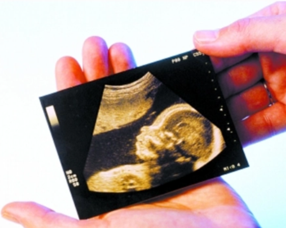 如何最早知道胎儿性别科学吗.png