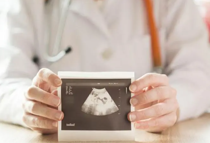 胎儿性别检测方法.png
