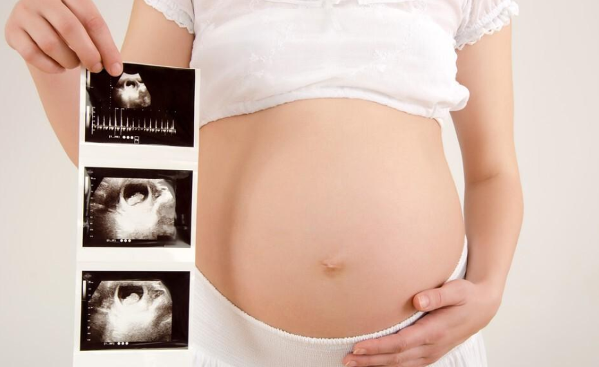 胎儿性别特征的评估是否需要专业知识？如何准确地预测宝宝的性别呢？.png