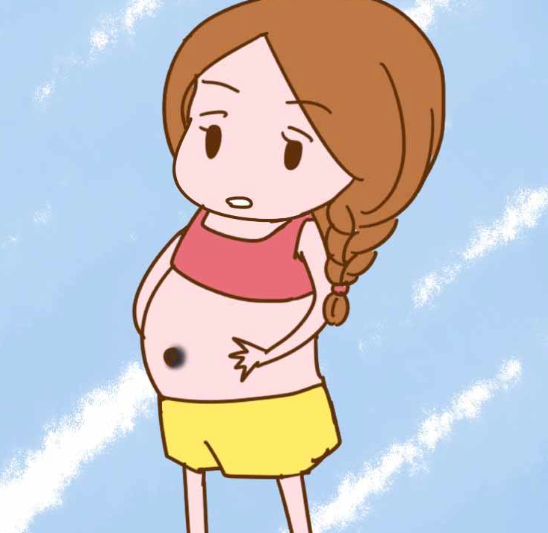 新生儿肚脐处突出和孕期肚脐凸起之间的联系.png