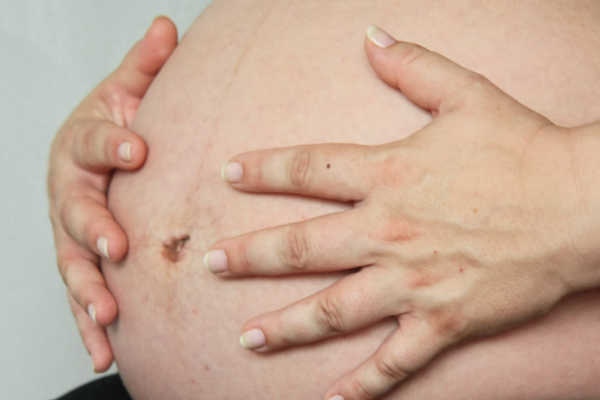 孕早期孕妇需要注意哪些事项？孕妇日常如何确保胎儿的健康发展？.png