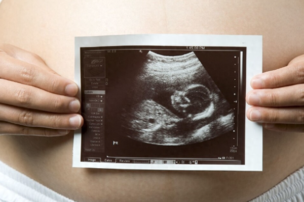 怀女儿孕酮会比怀怀男孩低吗？科学预测胎儿性别的方法有哪些？.png