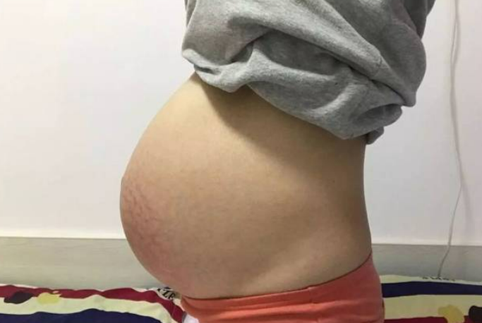 有输卵管堵塞和卵巢早衰能怀孕吗.png
