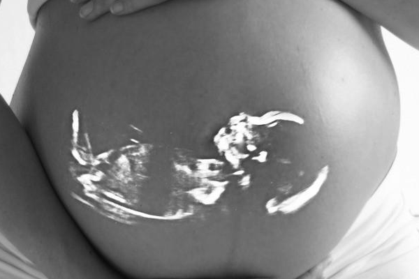 胎儿畸形容易发生在孕几周？.png