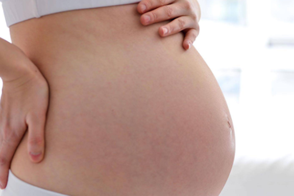 传统方法如何预测胎儿性别？.png