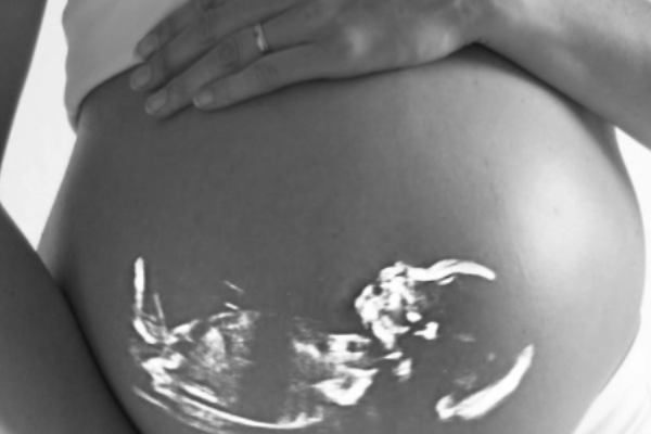 孕三个月如何自测胎儿性别？.png