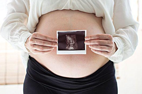孕期间如何预测出胎儿性别？.png