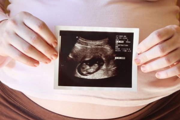 怎么准确确认胎儿性别？.png