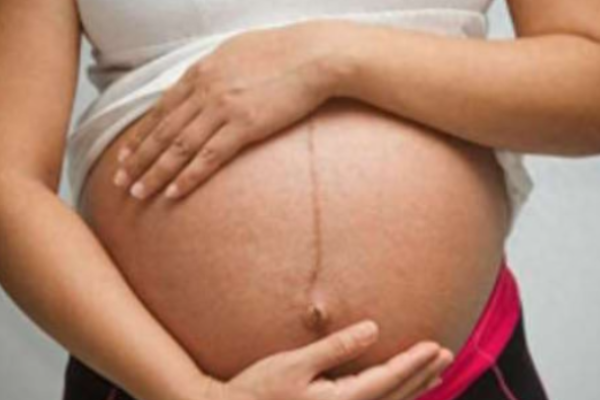 缓解孕妇尿频问题的方法有哪些？.png