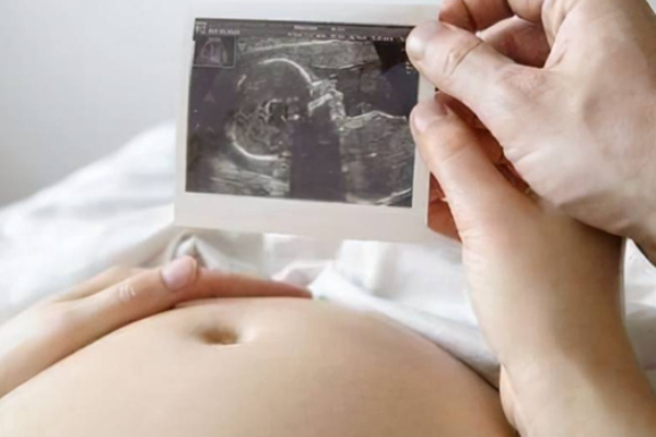 孕两个月的孕囊判断胎宝性别是否准确？.png